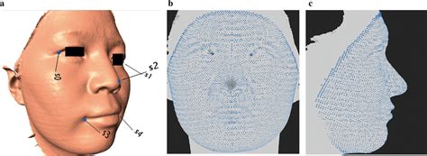 Demonstration Of Facial Mapping A Digitization Of Five Anchoring