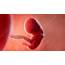 8 Week Old Fetus  Stock Video Clip K008/1720 Science Photo Library