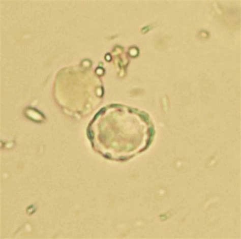 blastocystis hominis paraziti nedir vierme rotunde în gură