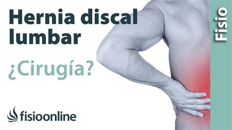 Hernia Discal Lumbar Cuándo Optar Por La Cirugía U Operación