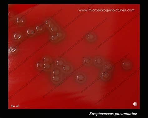 Streptococcus Pneumoniae Colony Morphology