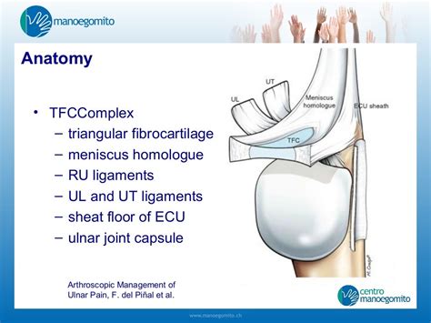 Acute Triangular Fibrocartilage Complex Injuries Treatment And Managem