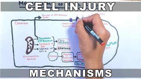 Mechanisms Of Cell Injury Youtube