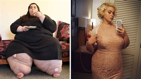 25 unbelievable before and after photos from ‘my 600 lb life
