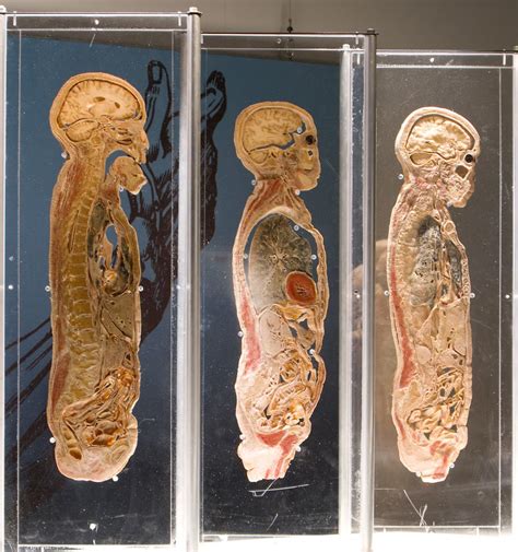 Bodies Revealed Returns To Science Center Lifestyles