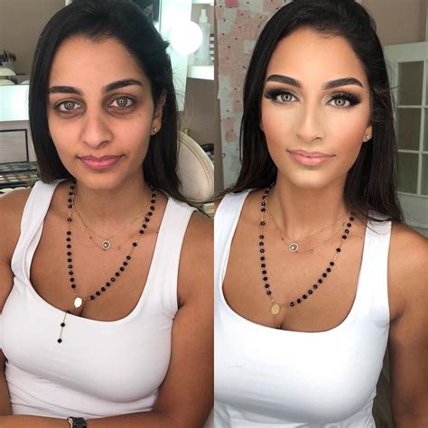 This Foundation Is Going Viral After Cystic Acne Sufferer Shares Her Insane Before And After