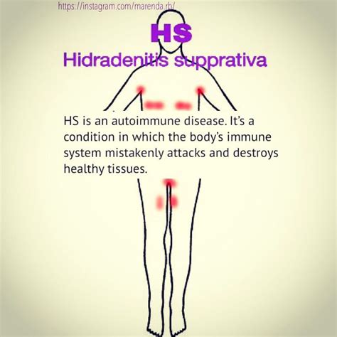 Hidradenitissupprativa Skindisorder Chronicillness Hidradenitis