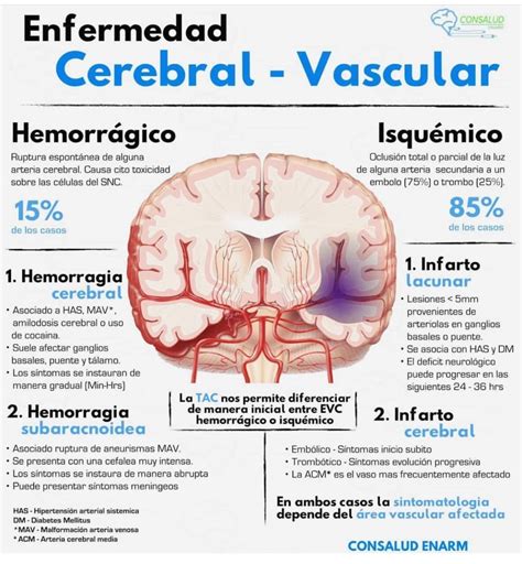 Enfermedad Cerebral Vascular Medicina De Urgencias Cosas De Enfermeria Medicina Humana