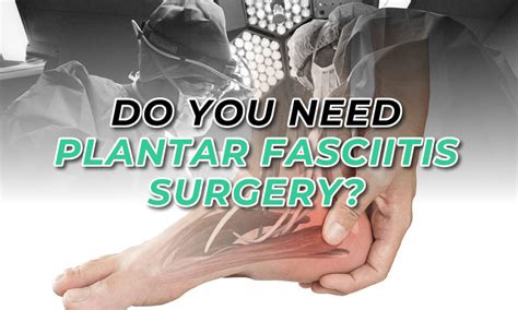 Plantar Fascia Surgery