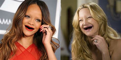 Weird Af Photos Of Hot Celebs Without Teeth Therichest
