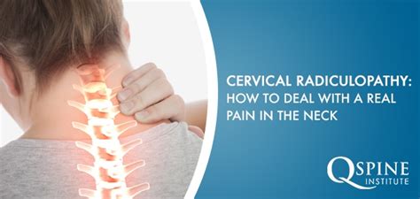 Cervical Radiculopathy How To Deal With A Real Pain In The Neck Q