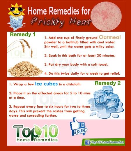 Home Remedies For Prickly Heat Top 10 Home Remedies