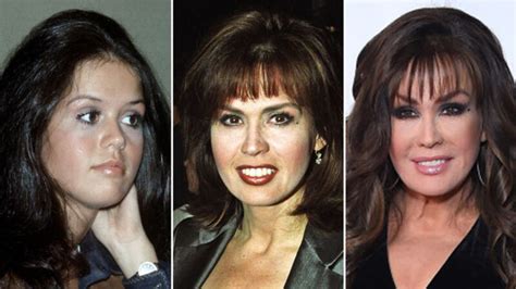 Marie Osmond Plastic Surgery Use Of Enhancements And Weight Loss Journey