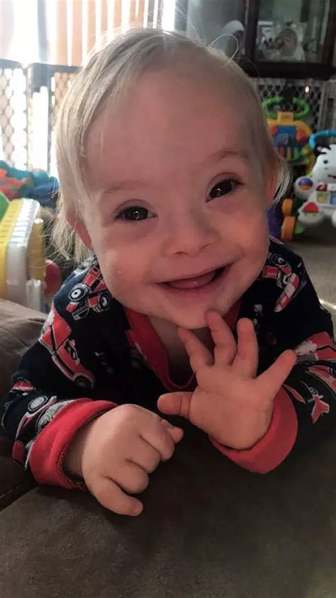 Adorable Boy Becomes First Gerber Baby With Downs Syndrome After