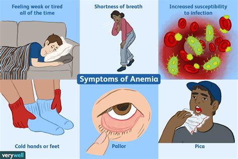 Causes And Symptoms Of Iron Deficiency Anemia And Diet Plan To Fight With