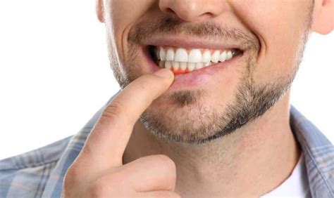 5 Warning Signs Of Gum Disease You Shouldnt Ignore