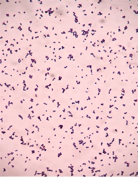 Gram Positive Cocci Under Microscope