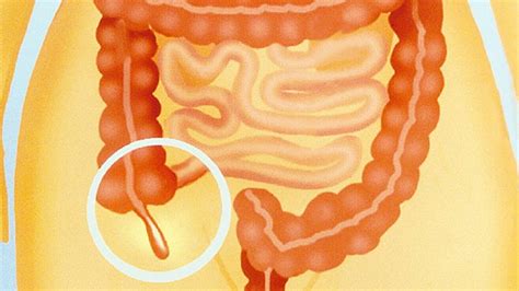 Human body diagram appendix position of the appendix youtube. 5 Useless Human Body Parts That Are Left Overs From ...