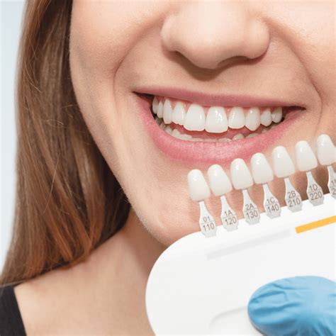 Teeth Whitening Overland KS Gilroy Dental Care