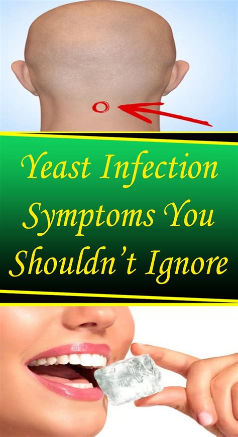 9 Yeast Infection Symptoms You Shouldnt Ignore Viral Nancie Blogspot Com