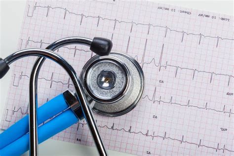 Stethoscope On Cardiogram Stock Photo Image Of Health 72932732