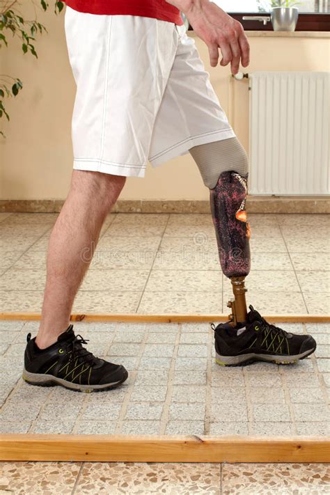 Male Prosthesis Wearer Training To Walk Uphill Stock Image Image Of