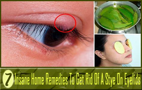 9 Most Common Eyelid Problems And Their Effective Treatments