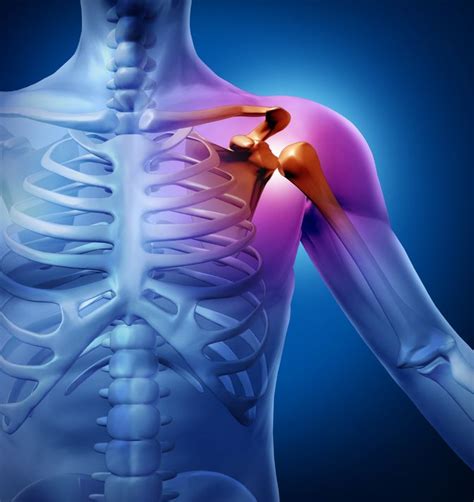 How Do You Know You Need Shoulder Surgery Plano Orthopedic And Sports