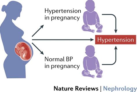 People with hypertension who smoke tobacco are at even greater risk for cardiovascular disease. Hypertension in pregnancy: a risk factor for the whole ...