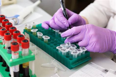 Pharmacy finder app will display complete list of nearby pharmacy with 10km range so it's cover high distance pharmacy finder app is also provide facility of load more nearby pharmacy and all the list of pharmacy will display. CRP Blood Test Might Support Reducing Antibiotics ...