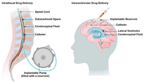 Ijms Free Full Text Approaches To Cns Drug Delivery With A Focus On