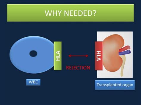 Basics Of Immunosuppression In Kidney Transplantation