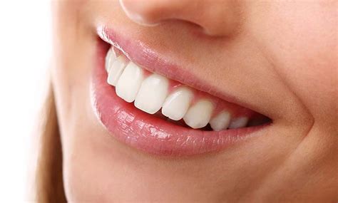 A New Smile With Dental Implants Abbotsford Dental Clinic