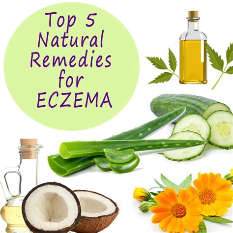 Top 5 Natural Remedies For Eczema With Images Natural Eczema