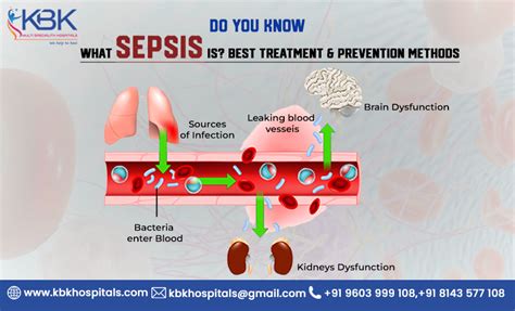Sepsis Infection