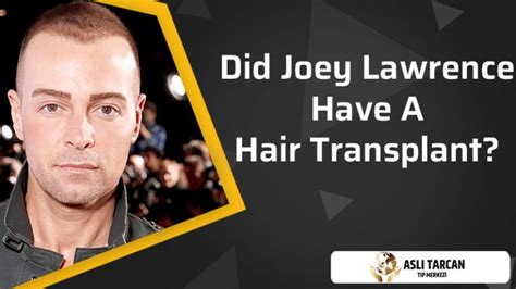 Did Joey Lawrence Have A Hair Transplant Asli Tarcan Clinic