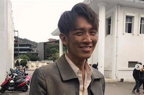 Actor Kai Ko Said To Be Seriously Disfigured After Drone Accident On Set Latest Tv News The