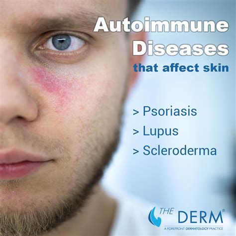 Autoimmune Diseases You Didnt Know Can Wreak Havoc On Your Skin