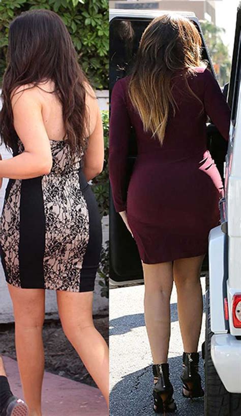 I talk a lot about how living with. Khloe Kardashian Butt Implants Before and After Photos ...
