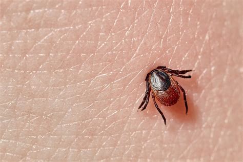 How To Treat And Prevent Tick Bites Health And Wellness 2023
