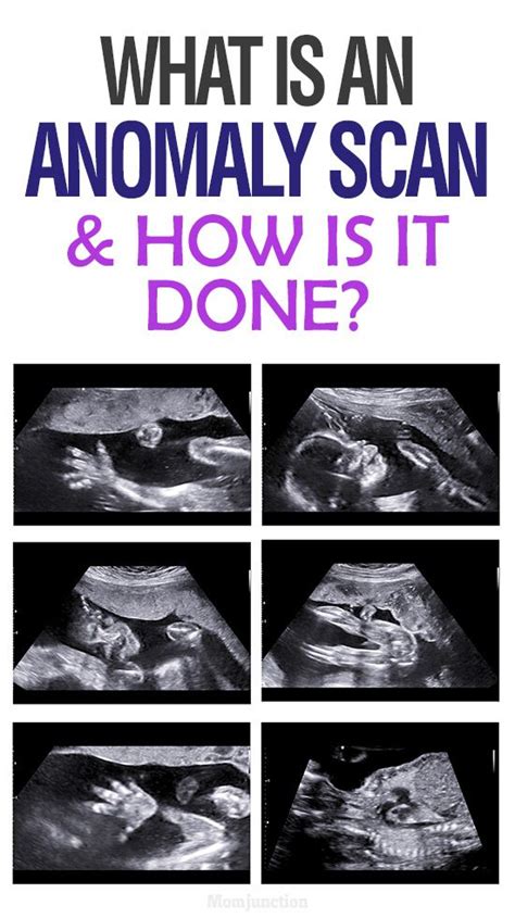 20 Weeks Pregnant Ultrasound Abnormalities