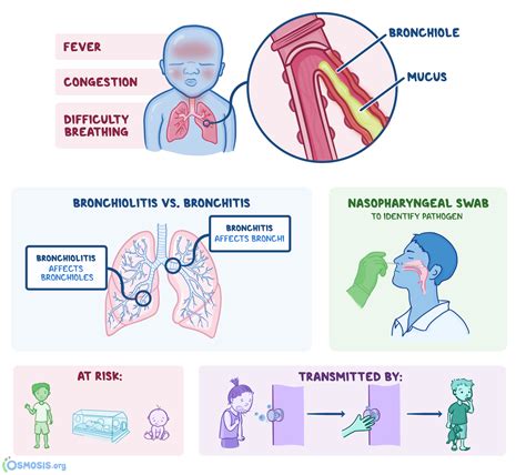 bronchiolitis what is it transmission symptoms treatment and more sexiezpix web porn