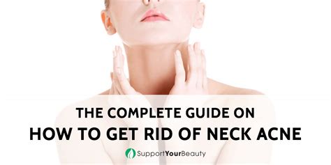 How To Get Rid Of Neck Acne Chest Acne Neck Acne Back Acne Treatment