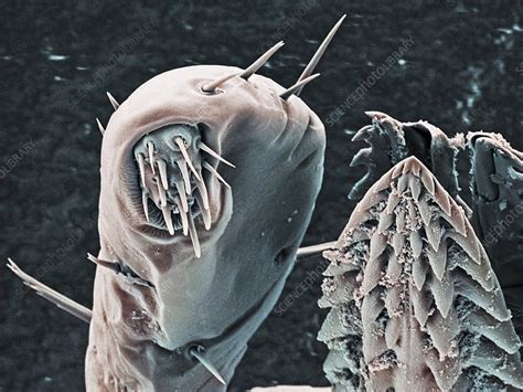 Tick Mouthparts Sem Stock Image C0148308 Science Photo Library