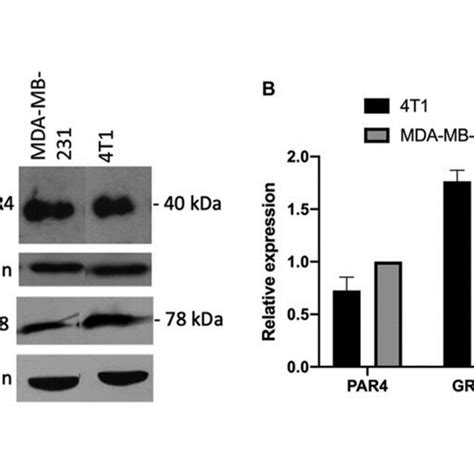 Basal Expression Of Prostate Apoptosis Response 4 PAR4 Protein And