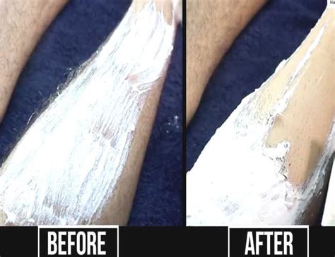 This Permanent Hair Removal At Home Mixture Helps You Remove Unwanted