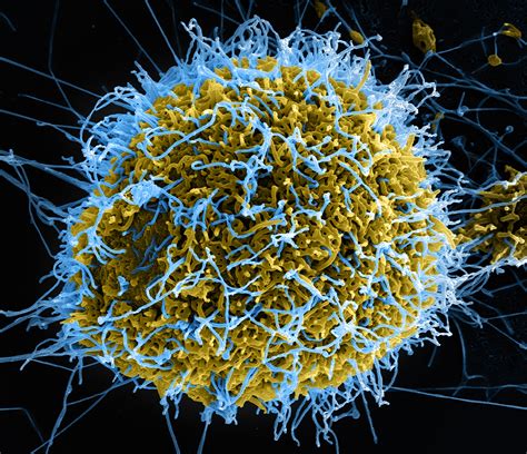 Understanding The Ebola Virus Ars Technica