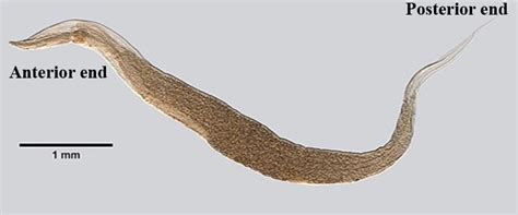 Enterobius Vermicularis Pinworm Adult Parasitology