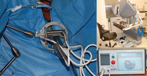 Real Time Robotic Transrectal Ultrasound Navigation During Robotic Radical Prostatectomy
