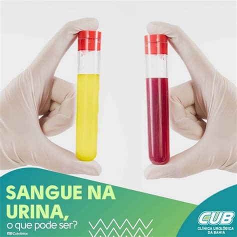 O que pode ser sangue na urina CUB Clínica Urológica da Bahia Urologista em Salvador